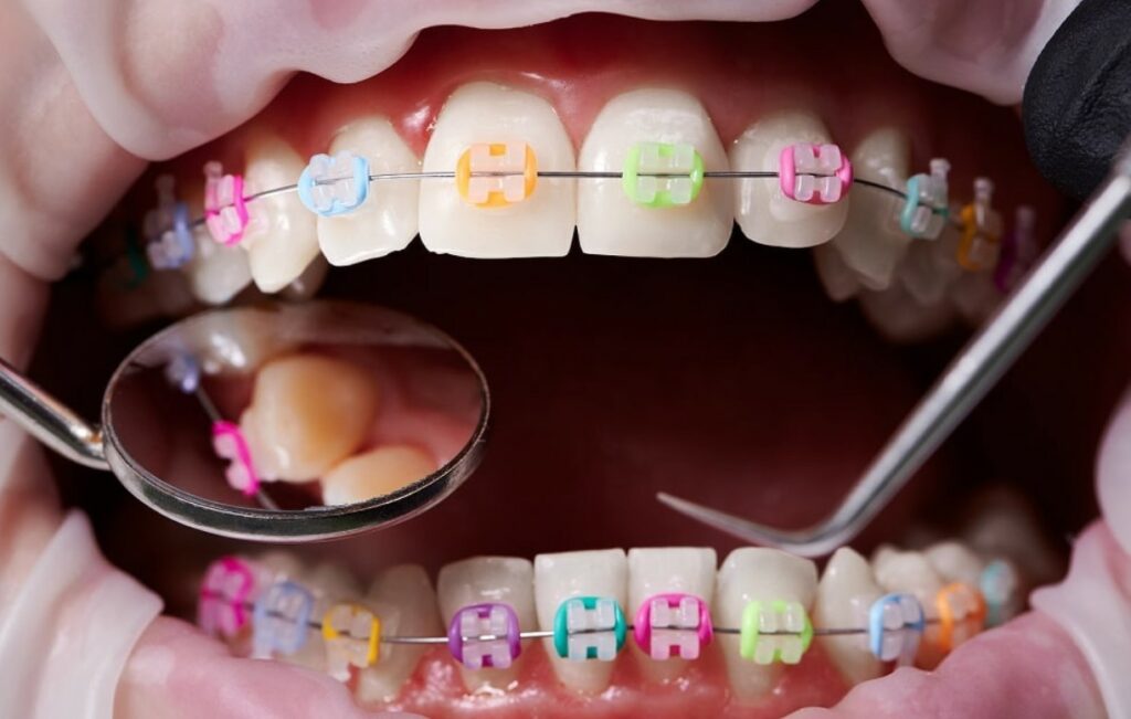 Ortodonti Uzmanı Maaşları